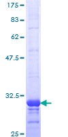 12.5% SDS-PAGE Stained with Coomassie Blue.